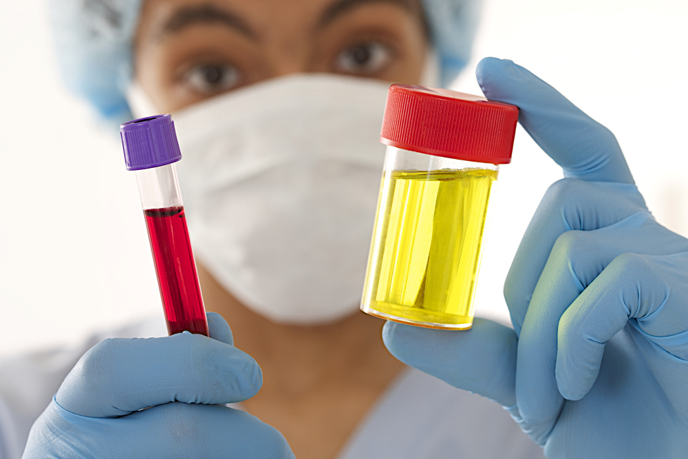 Young man doctor holding a urine and blood sample
